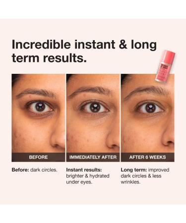 Shop iNNBEAUTY PROJECT Bright & Tight Dark Circle Firming Eye Cream with Vitamin C & Peptides - 0.5 oz / 15 mL Online - Best Price & International Shipping - Buy Online on GoSupps.com