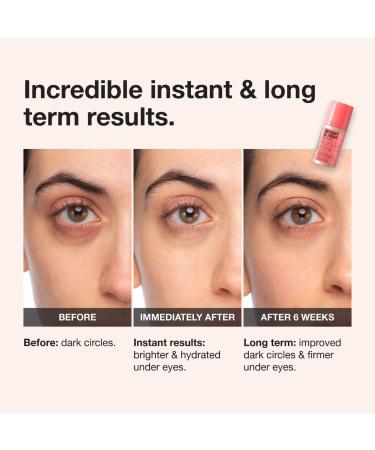 Shop iNNBEAUTY PROJECT Bright & Tight Dark Circle Firming Eye Cream with Vitamin C & Peptides - 0.5 oz / 15 mL Online - Best Price & International Shipping - Buy Online on GoSupps.com