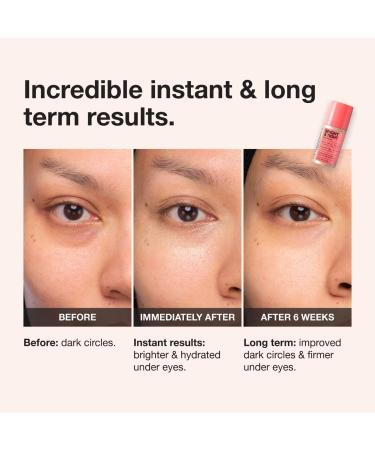 Shop iNNBEAUTY PROJECT Bright & Tight Dark Circle Firming Eye Cream with Vitamin C & Peptides - 0.5 oz / 15 mL Online - Best Price & International Shipping - Buy Online on GoSupps.com
