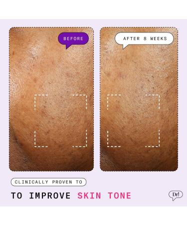 Shop Dr. Idriss Major Fade Active Seal Dark Spot Vitamin C Gel Moisturizer - 1.7 oz Online - Best Price & International Shipping - Buy Online on GoSupps.com