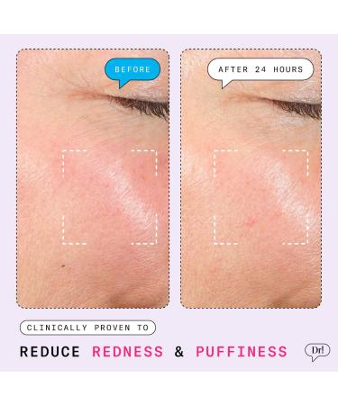 Shop Dr. Idriss The Depuffer Redness Reducing + Depuffing Roll-On Serum - 1.35 oz Online - Best Price & International Shipping - Buy Online on GoSupps.com