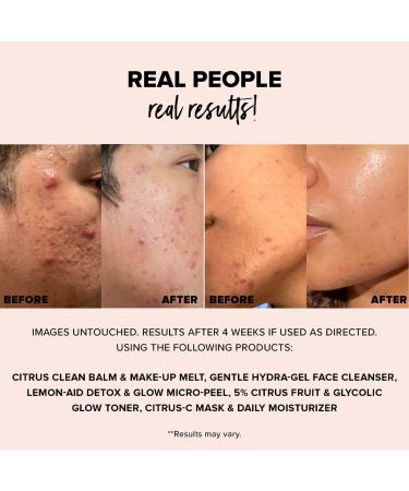 Shop NUDESTIX 5% Citrus Fruit & Glycolic Glow Toner - 3.4 oz / 95 ml Online - Best Price & International Shipping - Buy Online on GoSupps.com