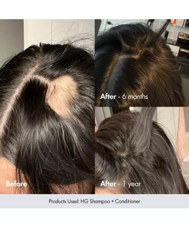 Shop BondiBoost HG Shampoo & Conditioner Set for Thinning Hair with Rosemary Online - Best Price & International Shipping - Buy Online on GoSupps.com