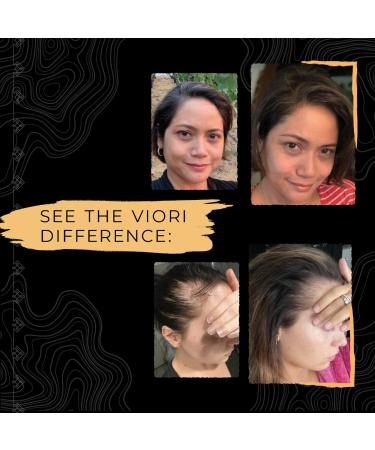 Shop Viori Mini Citrus Yao Shampoo & Conditioner Bar Set Online - Best Price & International Shipping - Buy Online on GoSupps.com