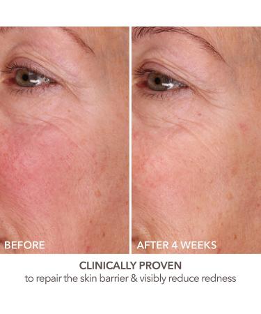 Shop Dr. Dennis Gross Skincare DermInfusions Fill + Repair Serum with Hyaluronic Acid - 1 oz / 30 mL Online - Best Price & International Shipping - Buy Online on GoSupps.com