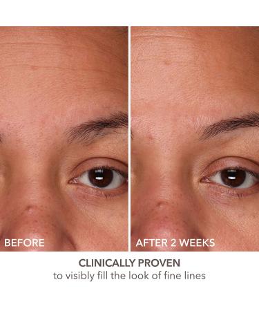 Shop Dr. Dennis Gross Skincare DermInfusions Fill + Repair Serum with Hyaluronic Acid - 1 oz / 30 mL Online - Best Price & International Shipping - Buy Online on GoSupps.com