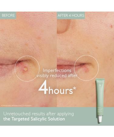 Shop Caudalie Vinopure Color Correcting Spot Solution with Salicylic Acid - .5 oz / 15 ml Online - Best Price & International Shipping - Buy Online on GoSupps.com