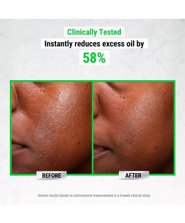 Shop Kiehl's Since 1851 Ultra Pure High-Potency 5.0% Niacinamide Serum - 1 oz / 30 ml Online - Best Price & International Shipping - Buy Online on GoSupps.com