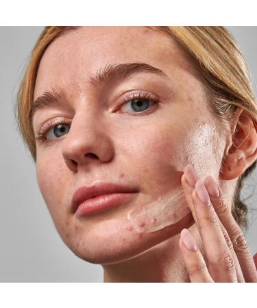 Shop The INKEY List SuperSolutions Acne Clearing Moisturizer 2% NOVORETIN - 1.7 oz / 50 ml Online - Best Price & International Shipping - Buy Online on GoSupps.com