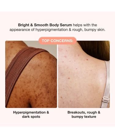 Shop iNNBEAUTY PROJECT Bright & Smooth Body Serum for Dark Spots & Bumps with 7% AHA + BHA - 5 oz / 150 mL Online - Best Price & International Shipping - Buy Online on GoSupps.com