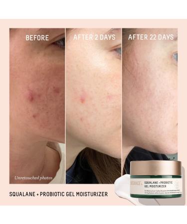Shop Biossance Squalane + Probiotic Balancing Gel Moisturizer - 1.69 oz / 50 mL Online - Best Price & International Shipping - Buy Online on GoSupps.com