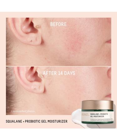 Shop Biossance Squalane + Probiotic Balancing Gel Moisturizer - 1.69 oz / 50 mL Online - Best Price & International Shipping - Buy Online on GoSupps.com