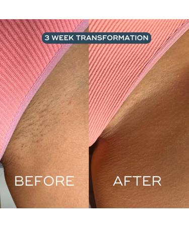 Shop Luna Daily The Mini Everywhere Oil - For Ingrowns Redness + Bumps - With Rosehip Oil Vitamins C & E - 0.4 oz / 10 mL Online - Best Price & International Shipping - Buy Online on GoSupps.com