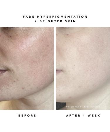 Shop Herbivore Milky Way 10% AHA + Oat Soothing Exfoliating Serum - 1 oz / 30 mL Online - Best Price & International Shipping - Buy Online on GoSupps.com