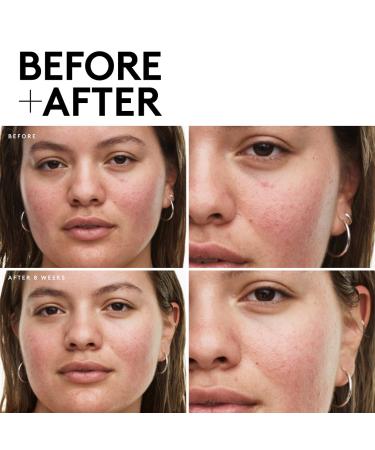 Shop Fenty Skin Travel-Size Start'r Set: Dry Skin Edition Online - Best Price & International Shipping - Buy Online on GoSupps.com