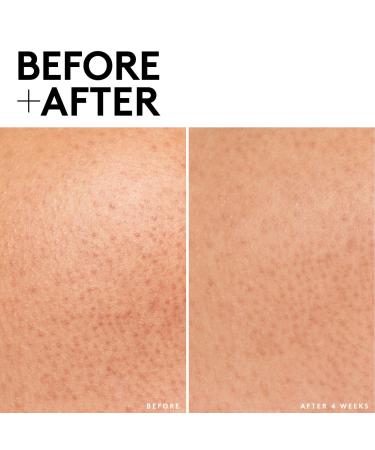 Shop Fenty Skin Cherry Dub Triple Action AHA Body Scrub - 8.5 oz / 240 mL Online - Best Price & International Shipping - Buy Online on GoSupps.com