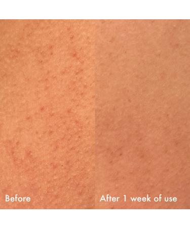 Shop Isle of Paradise Confidently Clear Body Cleansing Wash Lactic & Salicylic Acids - 11.15 oz / 330 mL Online - Best Price & International Shipping - Buy Online on GoSupps.com