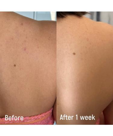 Shop Isle of Paradise Confidently Clear Body Cleansing Wash Lactic & Salicylic Acids - 11.15 oz / 330 mL Online - Best Price & International Shipping - Buy Online on GoSupps.com