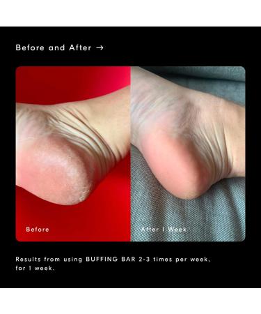 Shop Soft Services Buffing Bar Exfoliating Body Bar for KP and Ingrown Hair (2 pack) - 7.5 oz Online - Best Price & International Shipping - Buy Online on GoSupps.com