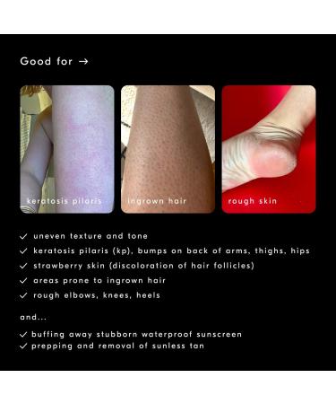 Shop Soft Services Buffing Bar Exfoliating Body Bar for KP and Ingrown Hair (2 pack) - 7.5 oz Online - Best Price & International Shipping - Buy Online on GoSupps.com