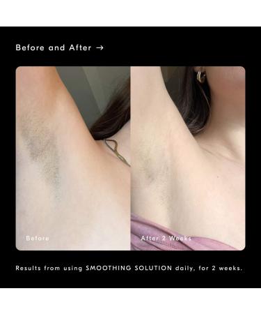 Shop Soft Services Smoothing Solution AHA Chemical Peel Body Exfoliator - 3.3 oz Online - Best Price & International Shipping - Buy Online on GoSupps.com