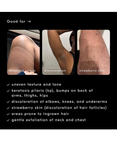 Shop Soft Services Smoothing Solution AHA Chemical Peel Body Exfoliator - 3.3 oz Online - Best Price & International Shipping - Buy Online on GoSupps.com