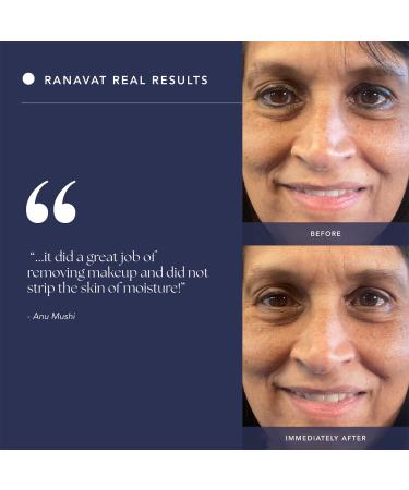 Shop RANAVAT Lotus Makeup Removing Cleansing Balm - 3.4 oz / 100 mL Online - Best Price & International Shipping - Buy Online on GoSupps.com