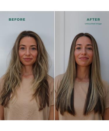 Shop SHAZ & KIKS Rice + Chai Scalp Refresh Spray for Healthy Hydrated Scalp - 4 oz / 130 ml Online - Best Price & International Shipping - Buy Online on GoSupps.com
