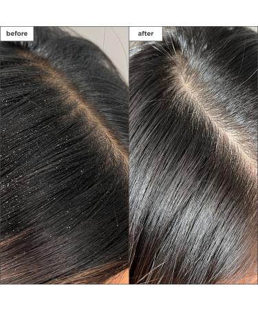 Shop Briogeo Scalp Revival Charcoal + Tea Tree Buildup Detox Spray - 4 oz / 120 ml Online - Best Price & International Shipping - Buy Online on GoSupps.com