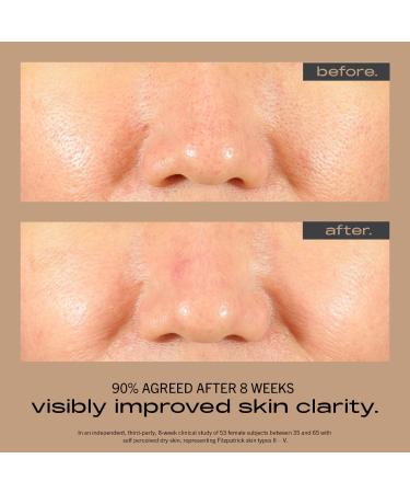 Shop MATTER OF FACT RESURFACING + HYDRATING Multi-Acid Serum with Salicylic Acid & Niacinamide - 1 oz / 30 ml Online - Best Price & International Shipping - Buy Online on GoSupps.com