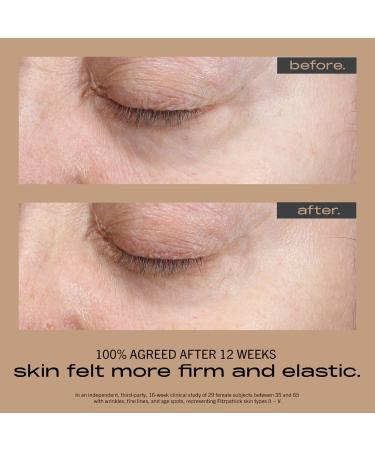 Shop MATTER OF FACT WRINKLE + TEXTURE CONCENTRATE with 0.2% Encapsulated Retinol Vitamin C & Azelaic Acid - 1 oz / 30 ml Online - Best Price & International Shipping - Buy Online on GoSupps.com