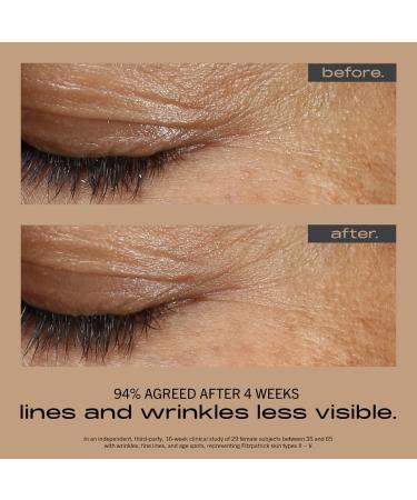 Shop MATTER OF FACT WRINKLE + TEXTURE CONCENTRATE with 0.2% Encapsulated Retinol Vitamin C & Azelaic Acid - 1 oz / 30 ml Online - Best Price & International Shipping - Buy Online on GoSupps.com