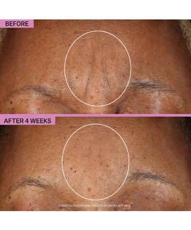 Shop StriVectin The Gamechangers Bundle Online - Best Price & International Shipping - Buy Online on GoSupps.com