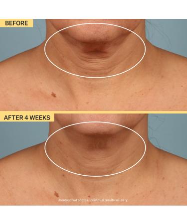 Shop StriVectin The Gamechangers Bundle Online - Best Price & International Shipping - Buy Online on GoSupps.com