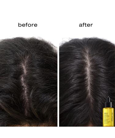 Shop shu uemura Essence Absolue Pre-Shampoo & Nourishing Treatment Oil for Scalp & Hair - 1.7 oz / 50 mL Online - Best Price & International Shipping - Buy Online on GoSupps.com