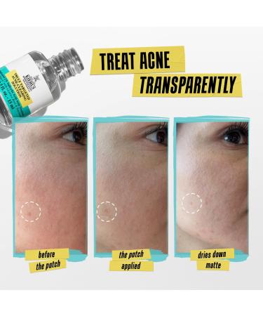 Shop Kiehl's Since 1851 Truly Targeted Acne-Clearing Pimple Patch with Salicylic Acid - Standard size Online - Best Price & International Shipping - Buy Online on GoSupps.com