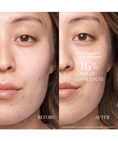 Shop fresh Lotus AHA Resurfacing Gentle Serum - 1 oz / 30 ml Online - Best Price & International Shipping - Buy Online on GoSupps.com