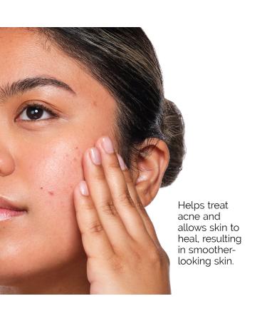 Shop The Ordinary The Acne Set Online - Best Price & International Shipping - Buy Online on GoSupps.com