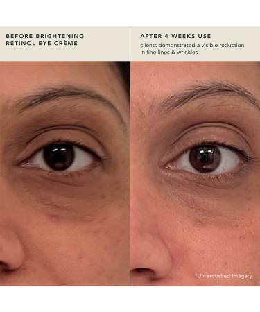 Shop RANAVAT Brightening Retinol Eye Creme for Fine Lines & Dark Circles - 0.5 oz Online - Best Price & International Shipping - Buy Online on GoSupps.com