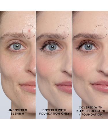 Shop Fenty Skin Blemish Defeat'r BHA Spot-Targeting Gel - 0.5 oz / 15 mL Online - Best Price & International Shipping - Buy Online on GoSupps.com