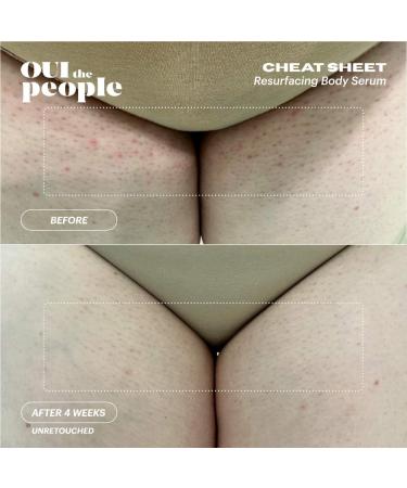 Shop OUI the People Cheat Sheet Resurfacing Body Exfoliant Serum with AHA + BHA - 3.4 oz / 100 ml Online - Best Price & International Shipping - Buy Online on GoSupps.com
