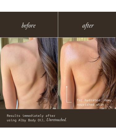 Shop Tabu Alby Restorative Body Oil for Sensitive & Dehydrated Skin - 4.3 oz / 127 ml Online - Best Price & International Shipping - Buy Online on GoSupps.com