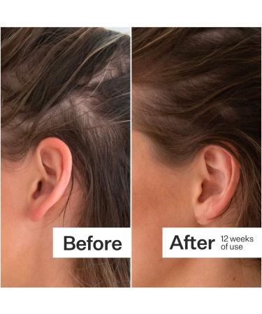 Shop Act+Acre Thick + Full Hair Capsules for Fuller-Looking Hair - 5.3 oz / 150 g Online - Best Price & International Shipping - Buy Online on GoSupps.com