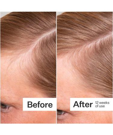 Shop Act+Acre Thick + Full Hair Capsules for Fuller-Looking Hair - 5.3 oz / 150 g Online - Best Price & International Shipping - Buy Online on GoSupps.com