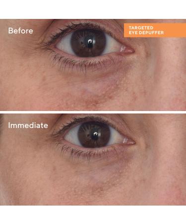 Shop Murad Targeted Eye Depuffer with Peptides - .5 oz / 15 ml Online - Best Price & International Shipping - Buy Online on GoSupps.com