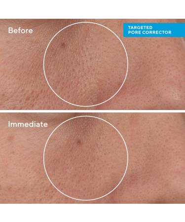 Shop Murad Targeted Pore Corrector - 0.5 oz / 15 ml Online - Best Price & International Shipping - Buy Online on GoSupps.com