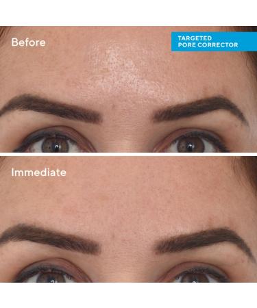 Shop Murad Targeted Pore Corrector - 0.5 oz / 15 ml Online - Best Price & International Shipping - Buy Online on GoSupps.com