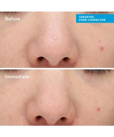 Shop Murad Targeted Pore Corrector - 0.5 oz / 15 ml Online - Best Price & International Shipping - Buy Online on GoSupps.com