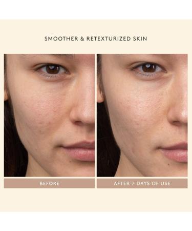 Shop Shani Darden Skin Care Lactic Acid AHA Exfoliating Serum - 1 oz / 30 ml Online - Best Price & International Shipping - Buy Online on GoSupps.com