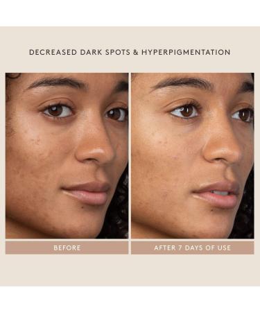 Shop Shani Darden Skin Care Lactic Acid AHA Exfoliating Serum - 1 oz / 30 ml Online - Best Price & International Shipping - Buy Online on GoSupps.com